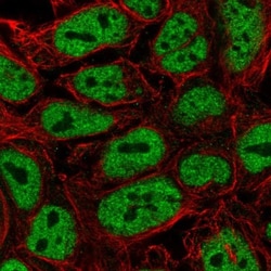 PWWP2A Antibody, Novus Biologicals 0.1mL; Unlabeled:Antibodies, Polyclonal